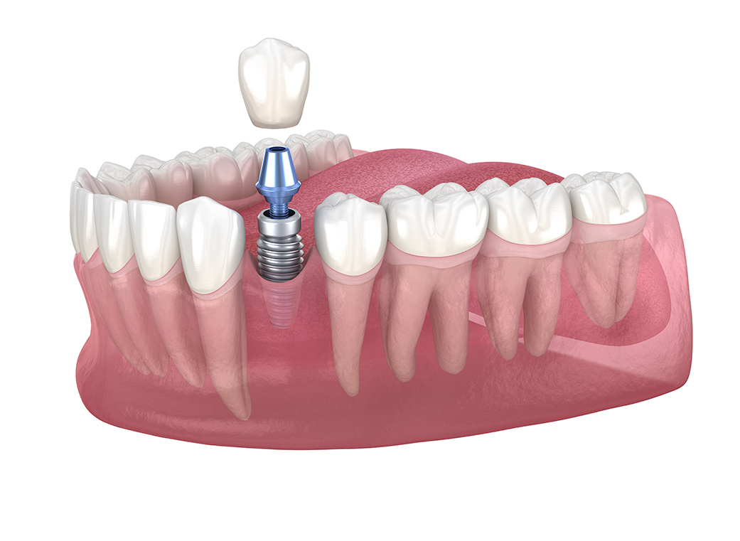適応できない症例もある