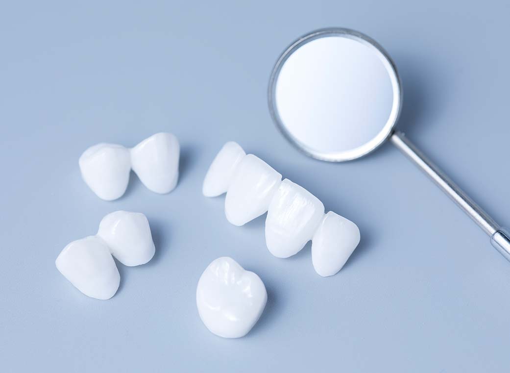 金属アレルギーのリスクを低減