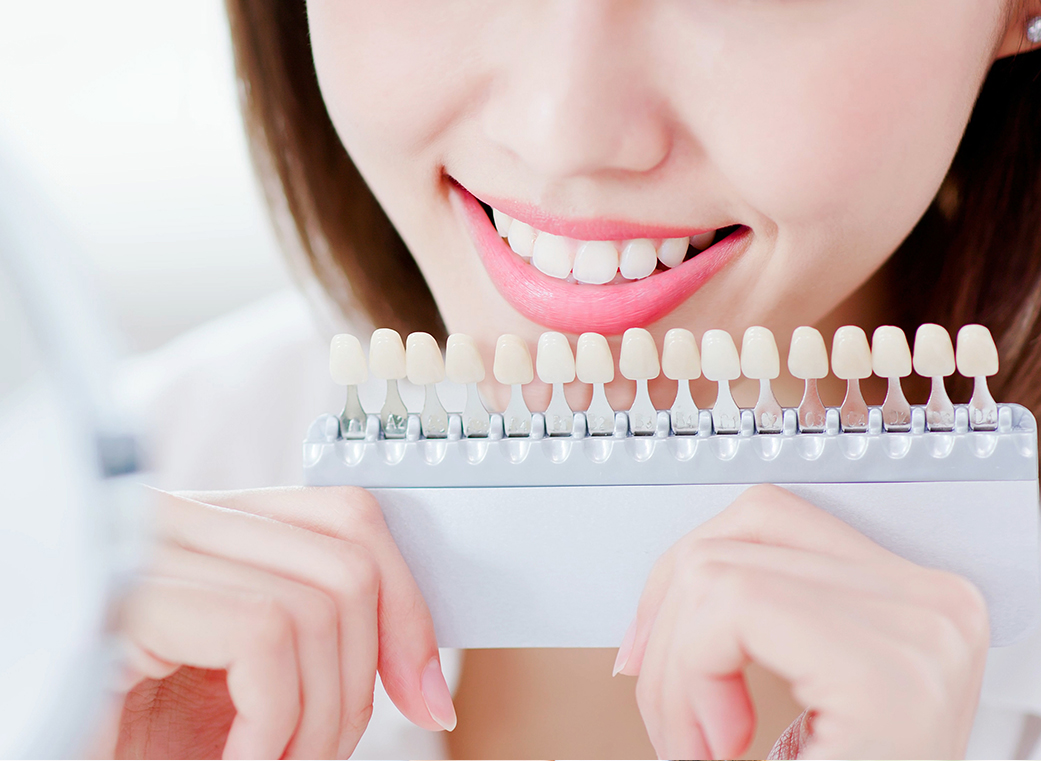 ラミネートベニアとはどのような治療？