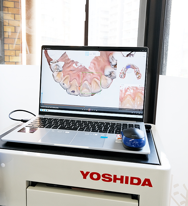 3D光学スキャナー